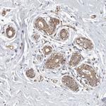 SERTAD4 Antibody in Immunohistochemistry (IHC)