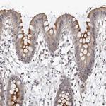 SERTAD4 Antibody in Immunohistochemistry (IHC)