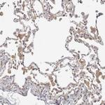 SERTAD4 Antibody in Immunohistochemistry (IHC)