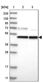 PARS2 Antibody in Western Blot (WB)