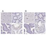 KIAA1751 Antibody in Immunohistochemistry (IHC)
