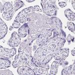 KIAA1751 Antibody in Immunohistochemistry (IHC)