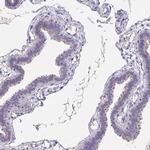 KIAA1751 Antibody in Immunohistochemistry (IHC)