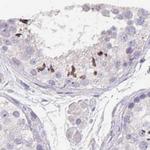 KIAA1751 Antibody in Immunohistochemistry (IHC)