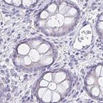 KIAA1751 Antibody in Immunohistochemistry (IHC)