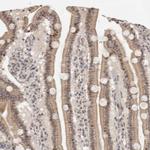 LRRC75A Polyclonal Antibody