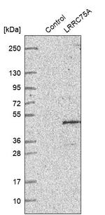 LRRC75A Antibody in Western Blot (WB)
