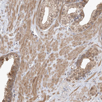 WDR26 Antibody in Immunohistochemistry (Paraffin) (IHC (P))