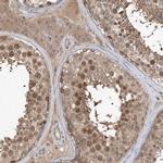 WDR26 Antibody in Immunohistochemistry (IHC)