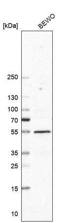 RNF92 Antibody in Western Blot (WB)
