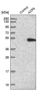 ACP6 Antibody in Western Blot (WB)