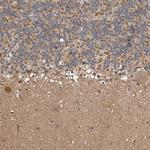 KIF26B Polyclonal Antibody