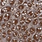 FLAD1 Polyclonal Antibody