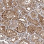 C1orf110 Polyclonal Antibody