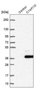 C1orf110 Antibody in Western Blot (WB)