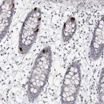 NUDT18 Antibody in Immunohistochemistry (Paraffin) (IHC (P))