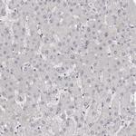 NUDT18 Antibody in Immunohistochemistry (Paraffin) (IHC (P))