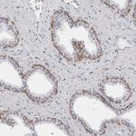 NUDT18 Antibody in Immunohistochemistry (Paraffin) (IHC (P))