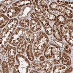C1orf110 Antibody in Immunohistochemistry (Paraffin) (IHC (P))