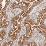 COA6 Antibody in Immunohistochemistry (Paraffin) (IHC (P))