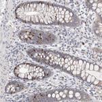 C1orf110 Polyclonal Antibody