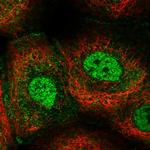 GPBP1L1 Polyclonal Antibody