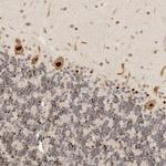 GPBP1L1 Antibody in Immunohistochemistry (Paraffin) (IHC (P))