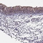 SPAG17 Polyclonal Antibody