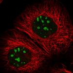 RBM34 Polyclonal Antibody