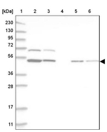 RBM34 Antibody in Western Blot (WB)