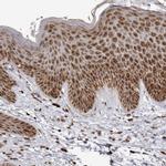 RBM34 Antibody in Immunohistochemistry (IHC)