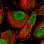 GCH1 Polyclonal Antibody