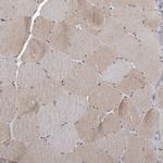 GCH1 Antibody in Immunohistochemistry (Paraffin) (IHC (P))