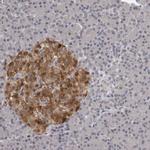 GCH1 Antibody in Immunohistochemistry (Paraffin) (IHC (P))