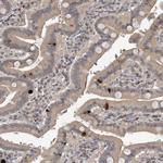 GCH1 Antibody in Immunohistochemistry (Paraffin) (IHC (P))