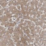 GCH1 Antibody in Immunohistochemistry (Paraffin) (IHC (P))