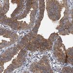 GEMIN8 Antibody in Immunohistochemistry (Paraffin) (IHC (P))