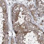 GEMIN8 Antibody in Immunohistochemistry (Paraffin) (IHC (P))