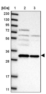 GEMIN8 Antibody in Western Blot (WB)