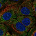 WDR65 Polyclonal Antibody