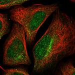 TARS2 Polyclonal Antibody