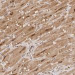 TARS2 Antibody in Immunohistochemistry (Paraffin) (IHC (P))