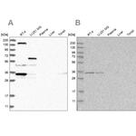 PPP1R42 Antibody in Western Blot (WB)