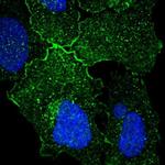 GPR156 Polyclonal Antibody