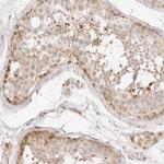 GPR156 Antibody in Immunohistochemistry (Paraffin) (IHC (P))