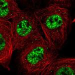 C1orf77 Polyclonal Antibody