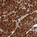 FAM129A Antibody in Immunohistochemistry (Paraffin) (IHC (P))