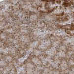 PIP4K2C Polyclonal Antibody