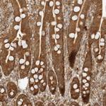 PRRC2C Antibody in Immunohistochemistry (IHC)