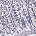 SPAG17 Antibody in Immunohistochemistry (Paraffin) (IHC (P))